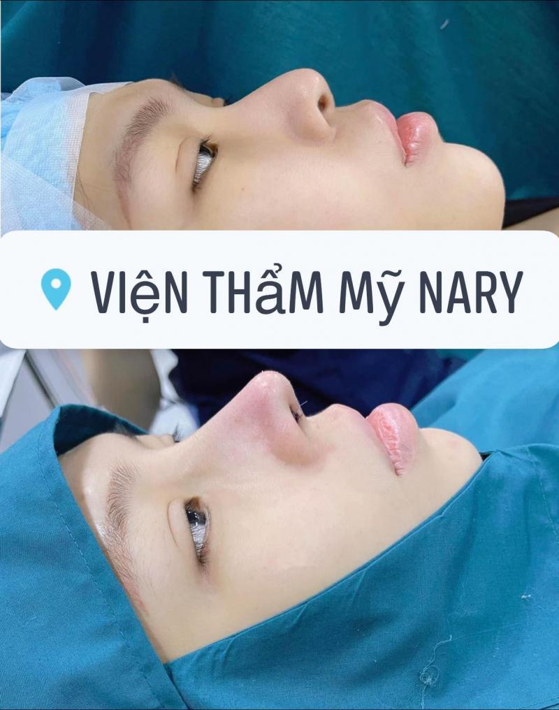 Top 4 Địa Chỉ Nâng Mũi Đẹp Và Đáng Tin Cậy Nhất Tại Ninh Thuận