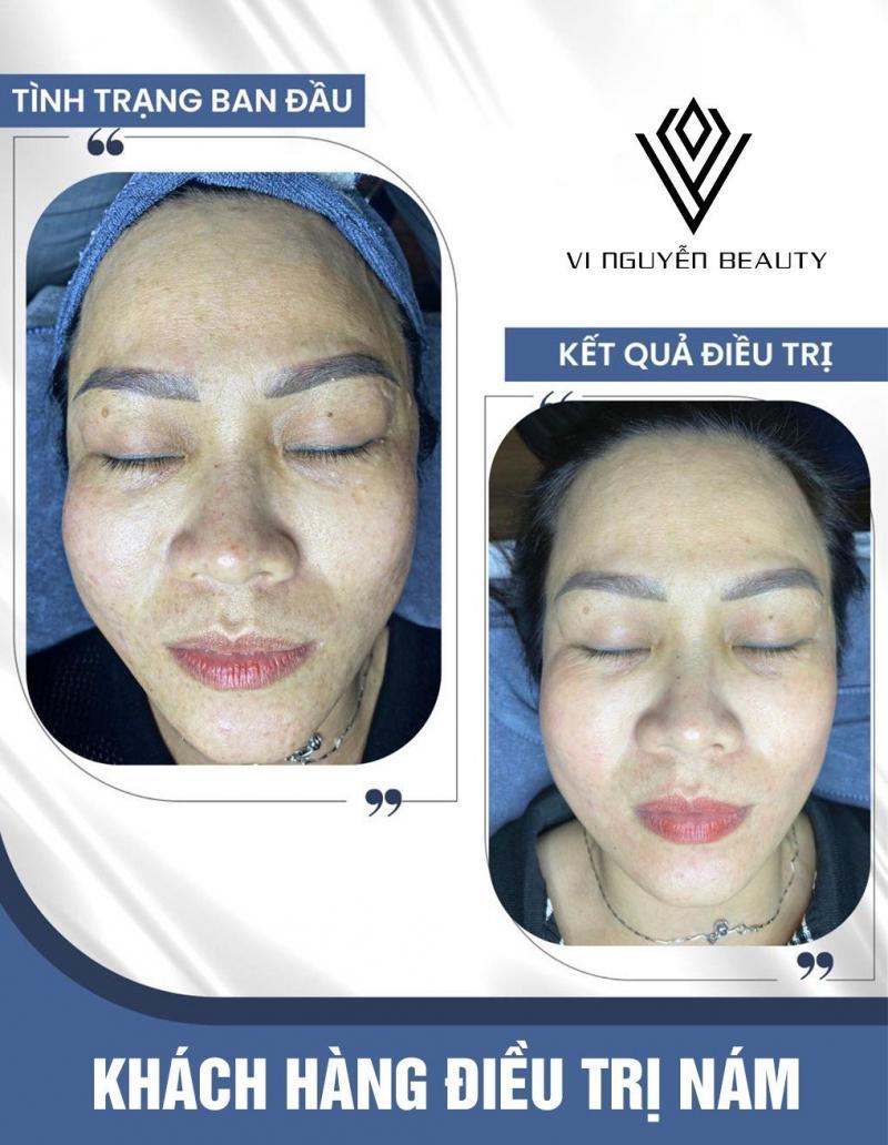 Top 3 phòng khám da liễu uy tín và chất lượng nhất tại tỉnh Kon Tum