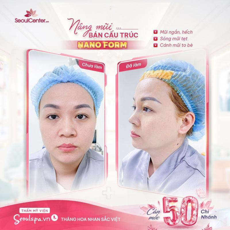 Top 3 địa chỉ nâng mũi đẹp và an toàn nhất tại Quảng Ngãi