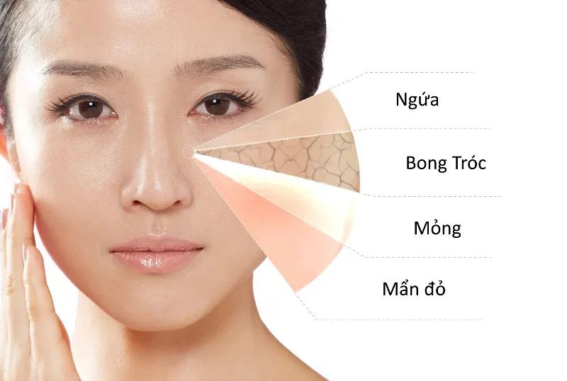3 tác dụng phụ khi rửa mặt bằng chanh mà phái đẹp cần đặc biệt lưu ý