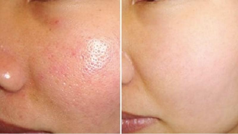 Rửa mặt bằng nước ấm mang lại nhiều lợi ích cho làn da, nhưng khi nào là thời điểm thích hợp để thực hiện?