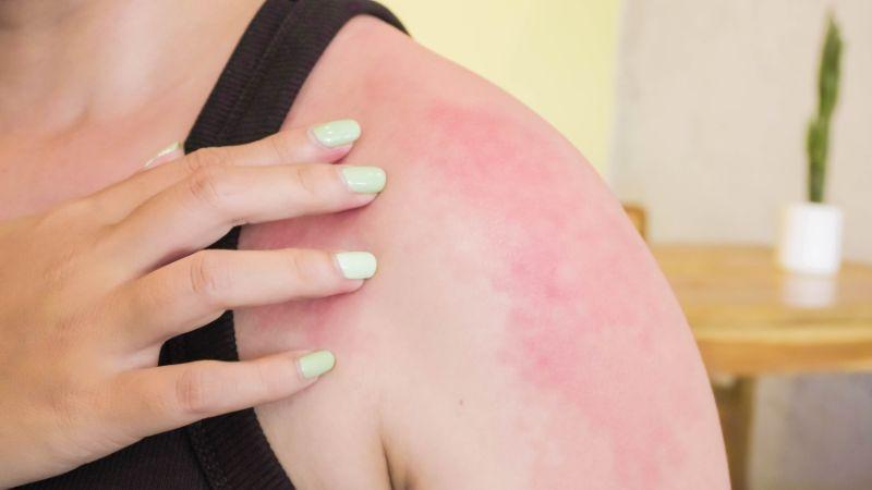 Thực hiện ngay bước này sau khi đi nắng về để làn da được làm dịu tức thì