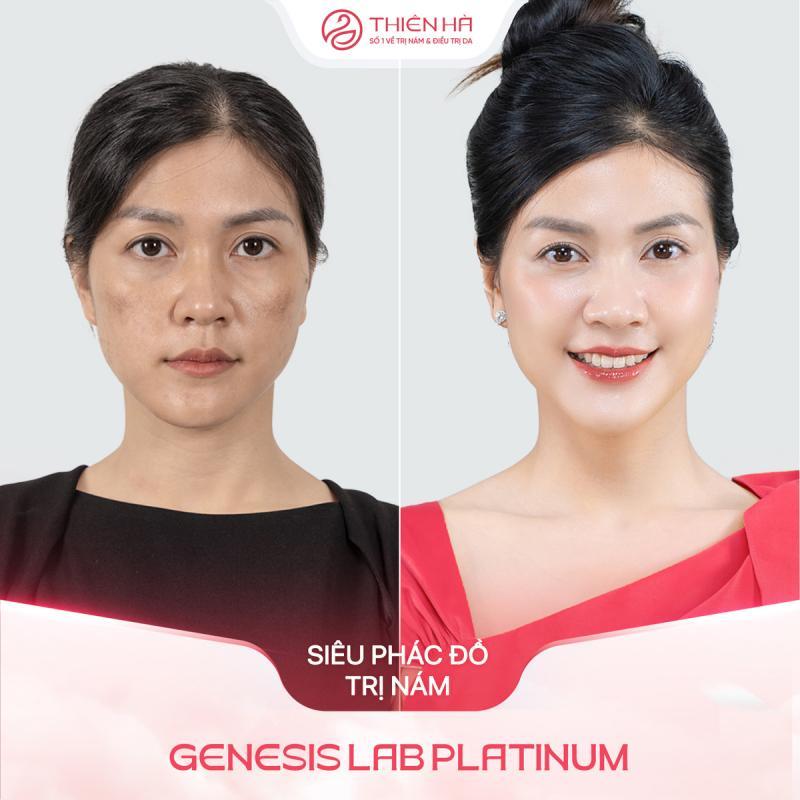8 Spa làm đẹp hàng đầu tại quận Cầu Giấy, Hà Nội