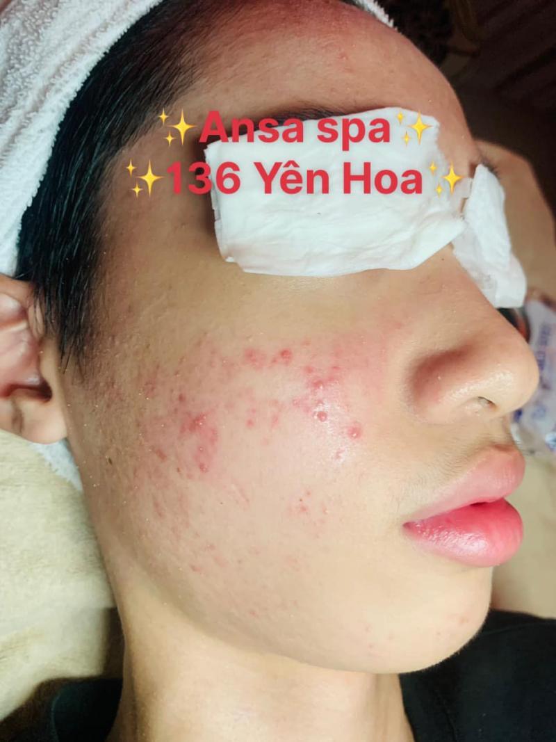 Top 6 spa chăm sóc da chất lượng nhất tại quận Tây Hồ, Hà Nội