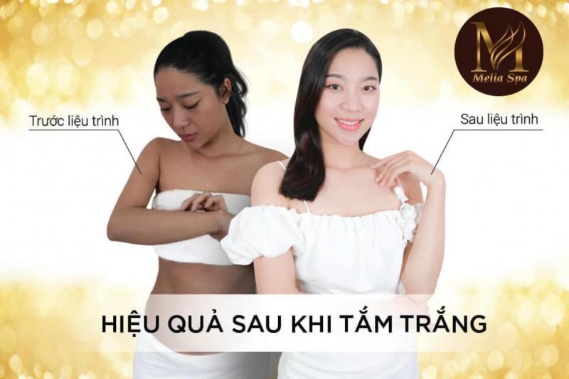 Top 3 spa tắm trắng chất lượng nhất tại Hà Tĩnh