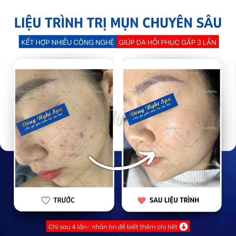 Top 9 spa làm đẹp uy tín và chất lượng nhất tại TP. Buôn Ma Thuột