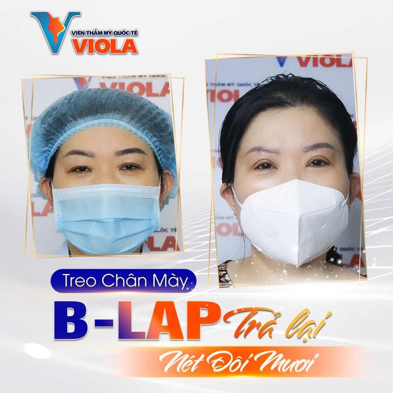 Top 7 địa chỉ nâng cung mày uy tín và đẹp nhất tại Đà Nẵng