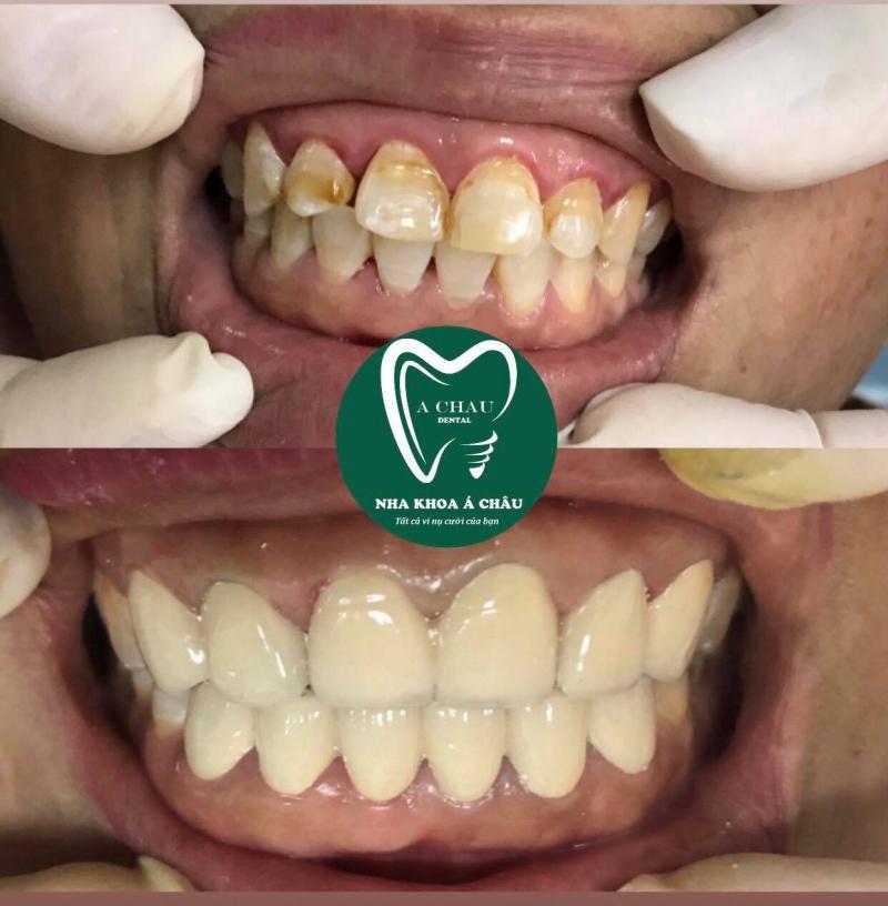 Danh sách 10 địa chỉ niềng răng uy tín hàng đầu tại Gia Lai