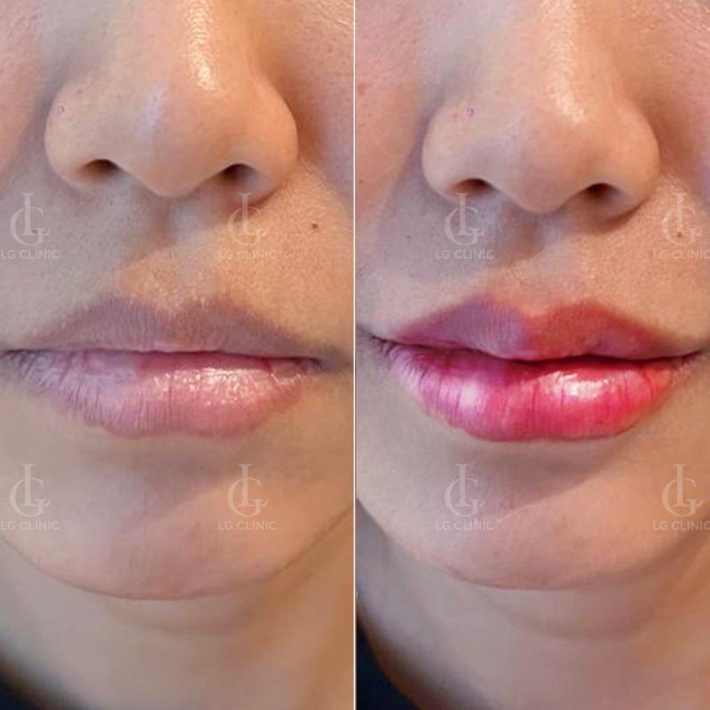 Top 5 Thẩm mỹ viện hàng đầu tại quận Tân Phú, TP. Hồ Chí Minh