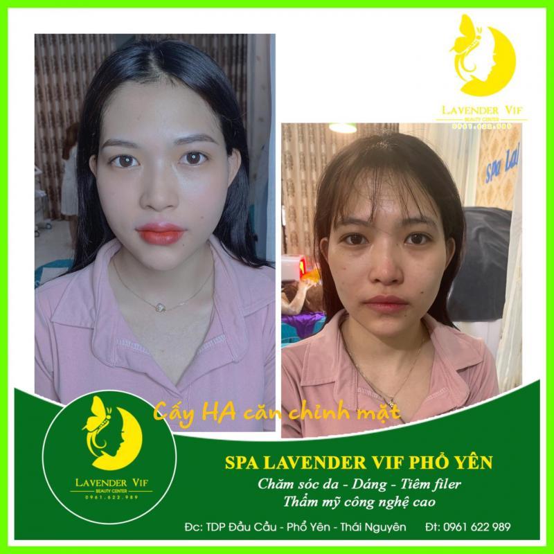 6 Spa làm đẹp uy tín nhất tại Phổ Yên, Thái Nguyên