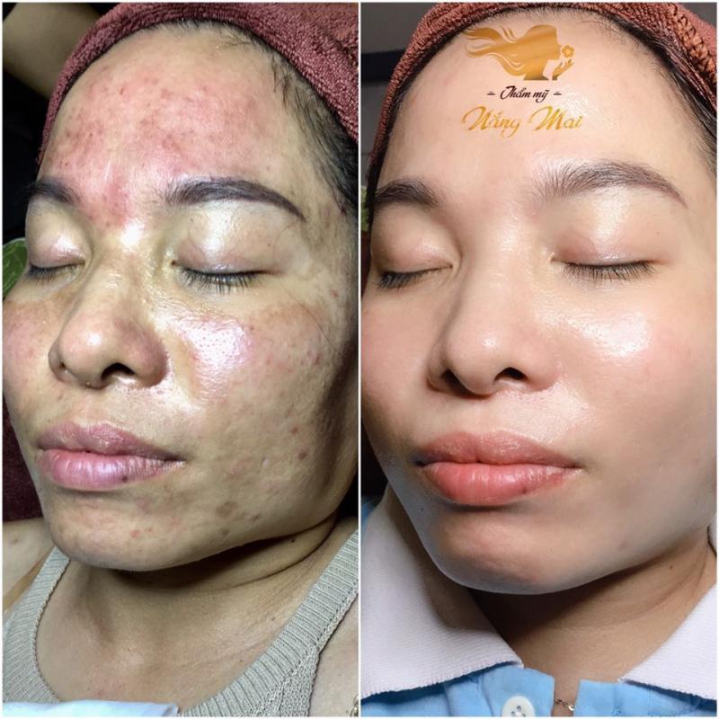 Top 6 spa làm đẹp uy tín tại quận 9, TP.HCM