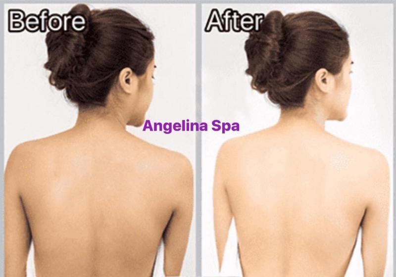Top 3 spa tắm trắng uy tín nhất tại TP. Phủ Lý, Hà Nam