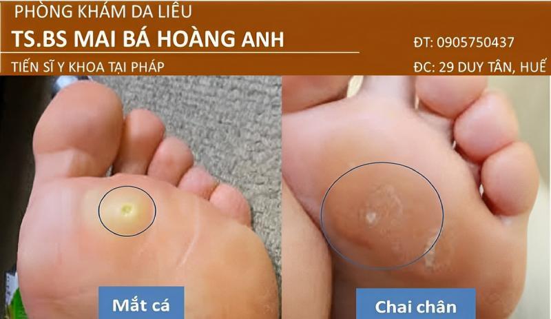 Top 5 bác sĩ da liễu thẩm mỹ uy tín tại Huế