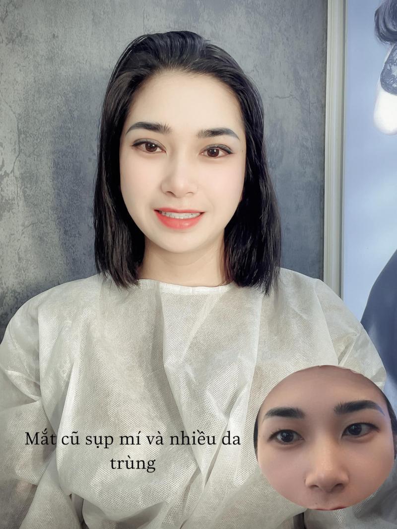 Top 6 địa chỉ nhấn mí, cắt mí đẹp và chất lượng tại Bắc Giang