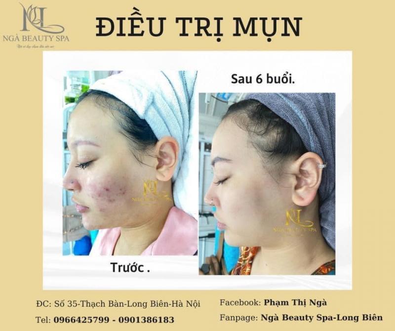 Top 7 Spa làm đẹp hàng đầu tại quận Long Biên, Hà Nội