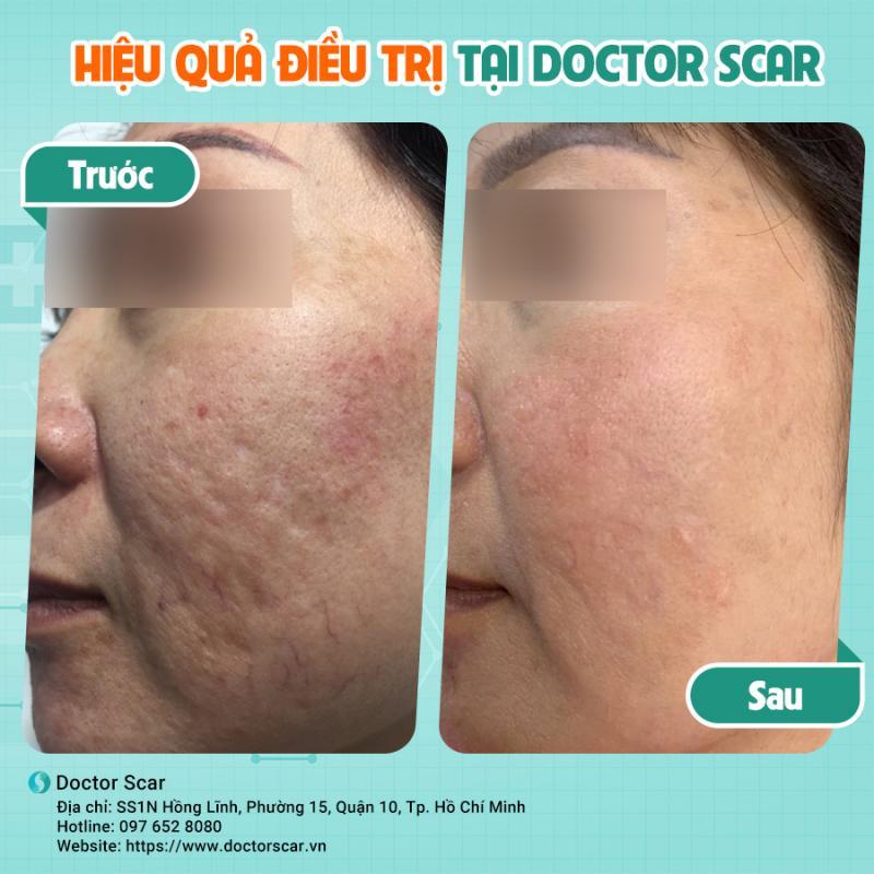 Top 8 phòng khám trị sẹo uy tín tại TP. HCM