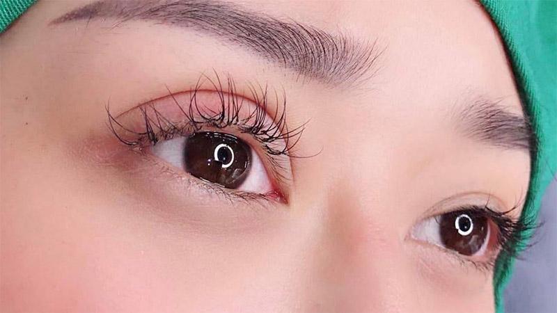 Top 8 địa chỉ cắt mí, nhấn mí uy tín và chất lượng nhất tại Hà Tĩnh
