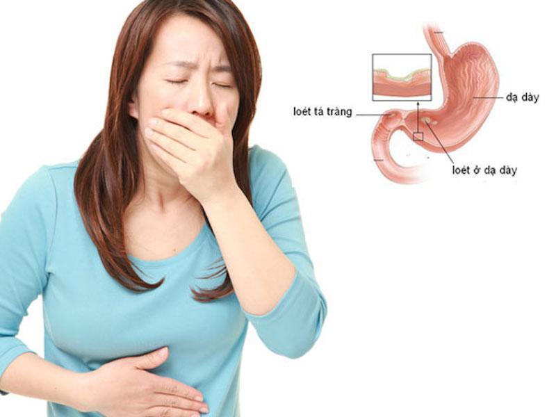 7 Địa chỉ khám và điều trị viêm loét dạ dày uy tín tại TP. Hồ Chí Minh