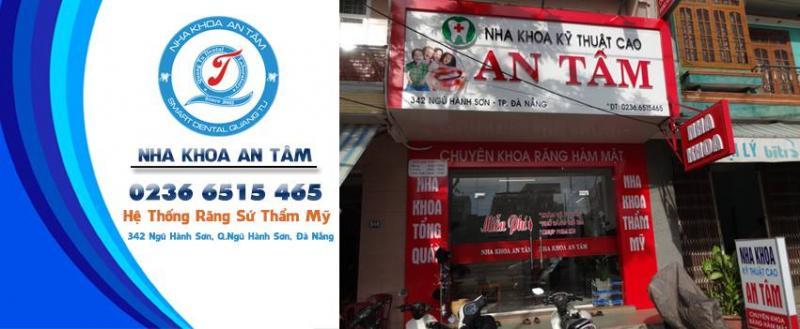 Top 10 Nha khoa uy tín và chất lượng để nhổ răng khôn tại Đà Nẵng