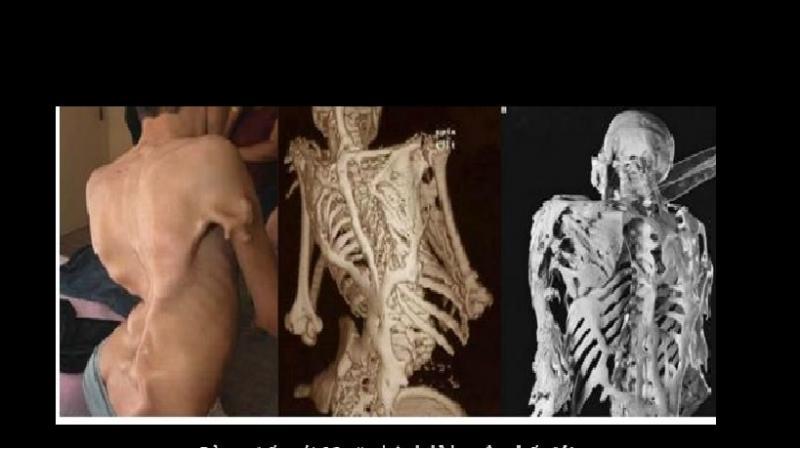 Top 10 căn bệnh kỳ lạ và khó tin trên thế giới