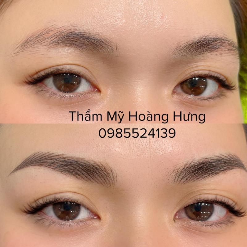 Top 8 thẩm mỹ viện chất lượng và uy tín nhất tại quận Bình Thạnh, TP. HCM