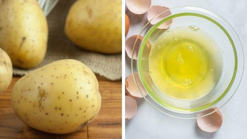 3 phương pháp hiệu quả để ngăn ngừa giày da bị bong tróc