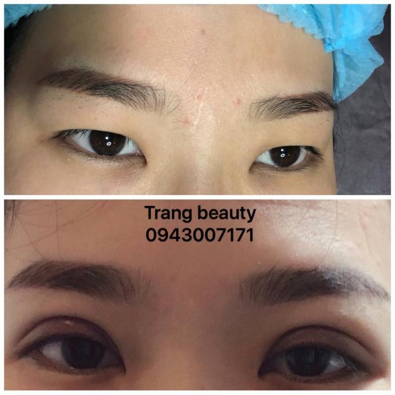 Khám phá 4 địa chỉ uy tín nhất Biên Hòa, Đồng Nai chuyên cung cấp dịch vụ nhấn mí và cắt mí đẹp, an toàn, giúp bạn sở hữu đôi mắt sắc sảo và quyến rũ.