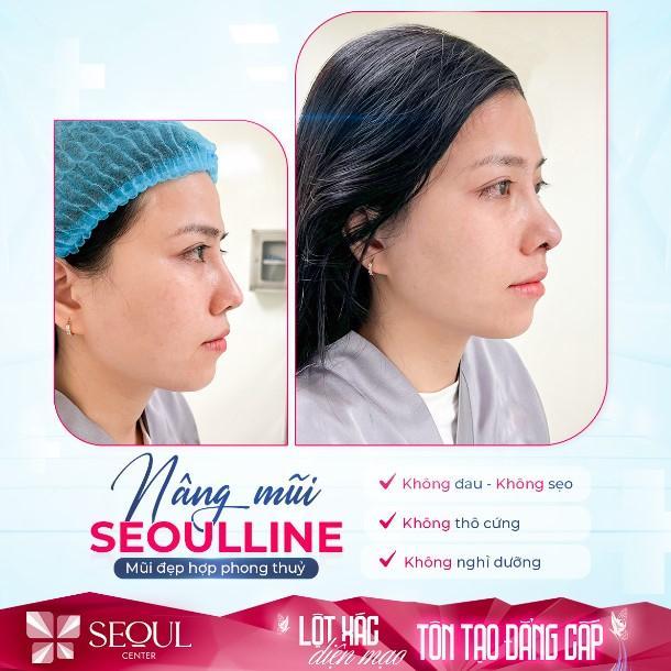 Top 7 Thẩm mỹ viện nâng mũi trả góp chất lượng tại TP. Hồ Chí Minh