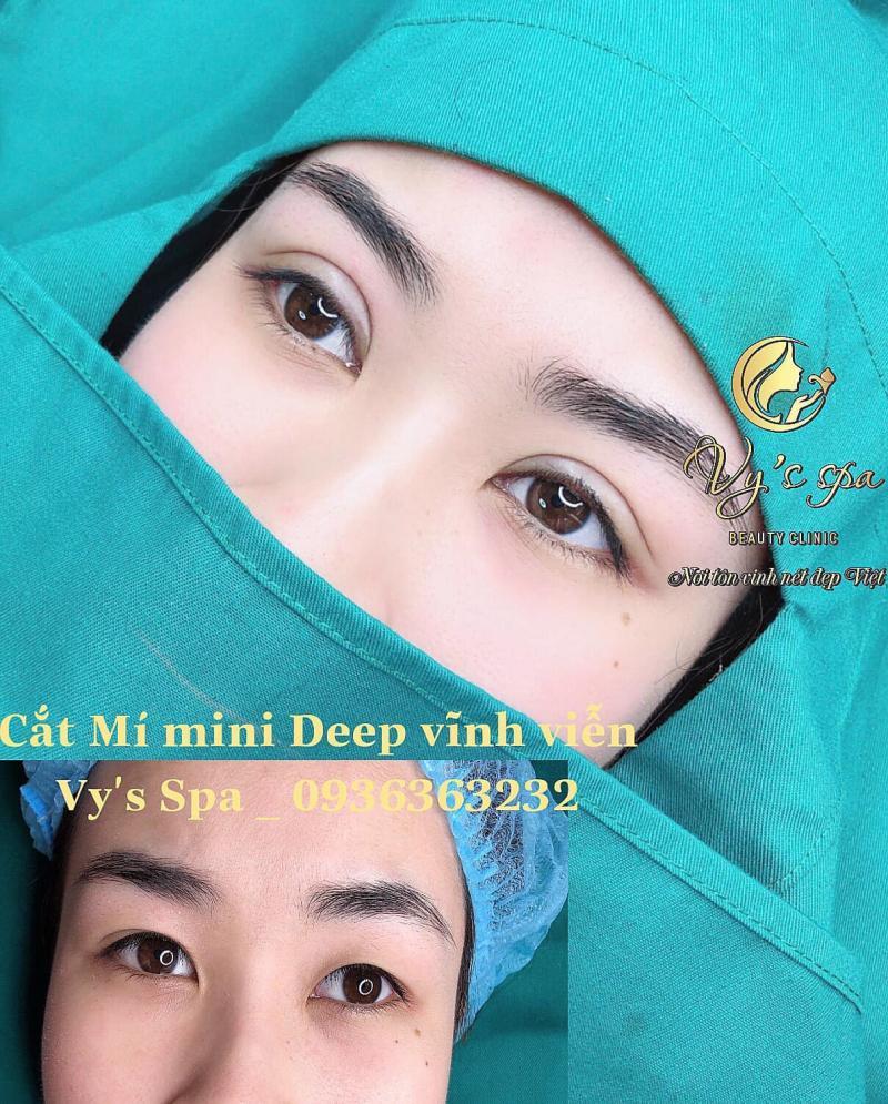 Top 6 địa chỉ nhấn mí đẹp và an toàn nhất tại Bà Rịa - Vũng Tàu