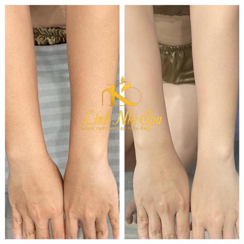 Top 7 Spa tắm trắng uy tín hàng đầu tại Kiên Giang