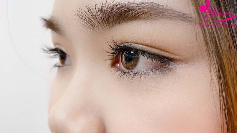 8 địa chỉ nhấn mí an toàn và hiệu quả nhất tại TP. Vinh, Nghệ An