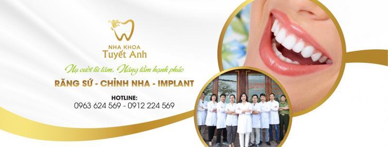 Top 5 địa chỉ niềng răng mắc cài sứ dây trong uy tín nhất tại Nam Định