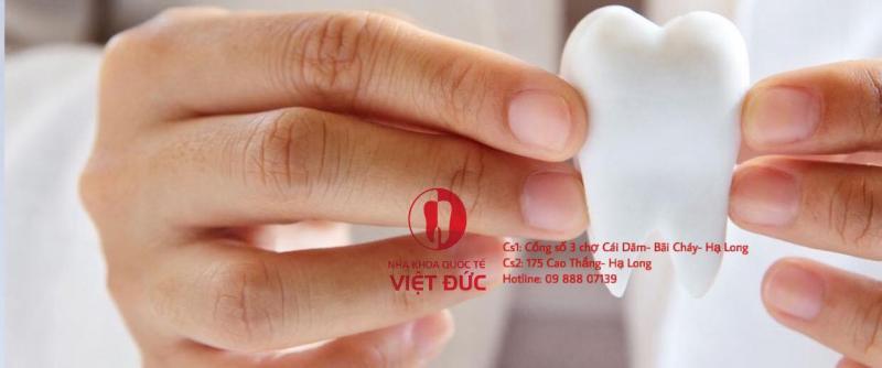 Top 5 địa chỉ niềng răng trả góp uy tín tại Quảng Ninh - Tripi