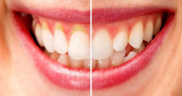 Top 10 Cách chăm sóc răng miệng và nướu hiệu quả