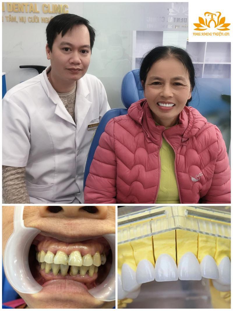 Top 6 phòng khám nha khoa uy tín tại TP. Vĩnh Yên, Vĩnh Phúc