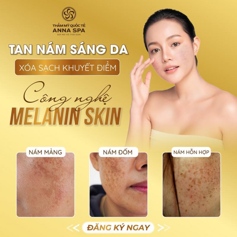 Top 8 spa trị nám uy tín nhất tại TP. Long Khánh, Đồng Nai