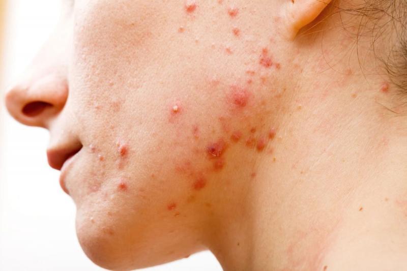 10 dấu hiệu thay đổi trên cơ thể bạn có thể tiết lộ tình trạng sức khỏe tiềm ẩn