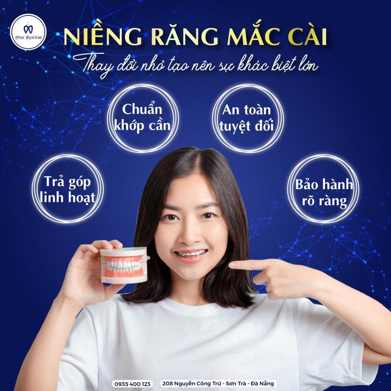 Top 6 Nha khoa uy tín tại Đà Nẵng chuyên niềng răng mắc cài sứ dây trong