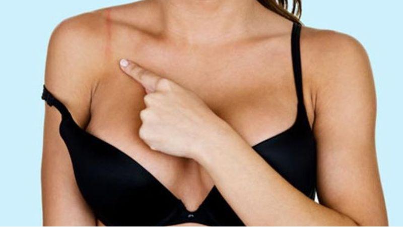 Những rủi ro khi chọn áo ngực không phù hợp mà chị em cần lưu ý