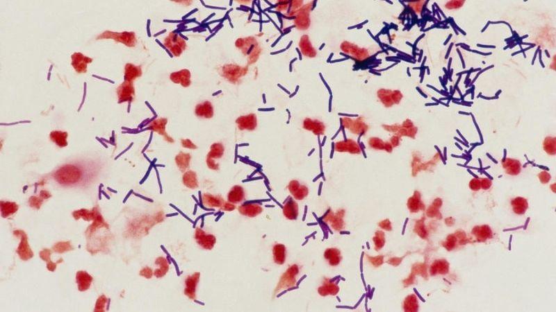 Lactobacillus acidophilus là gì và nó có tác dụng gì đối với cơ thể của chúng ta?