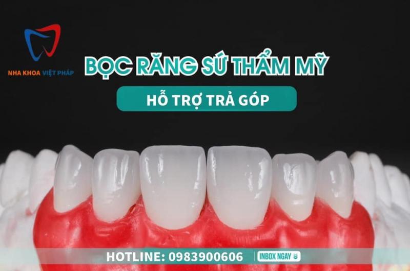 Top 8 địa chỉ bọc răng sứ uy tín nhất tại Bắc Giang không thể bỏ qua