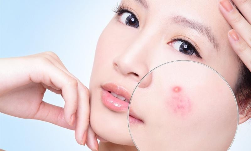 13 Tác dụng chữa bệnh của củ tỏi
