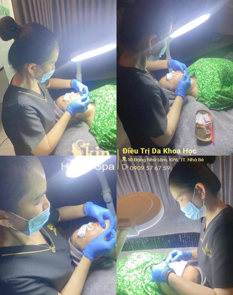 Top 7 Địa chỉ trị mụn chất lượng tại huyện Nhà Bè, TP. Hồ Chí Minh
