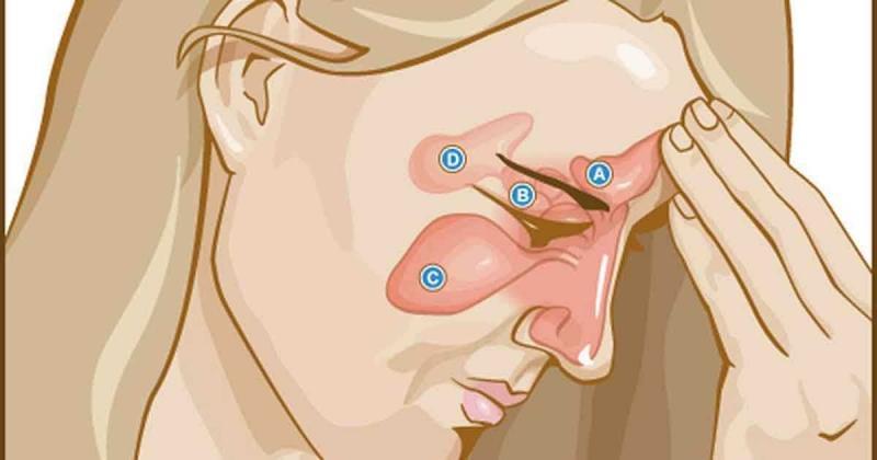 Top 10 loại bệnh đau đầu phổ biến nhất