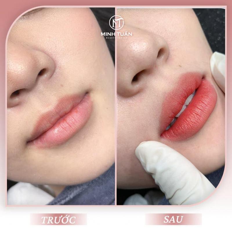 7 Địa Chỉ Phun Môi Đẹp Nhất Quận 8, TP. HCM