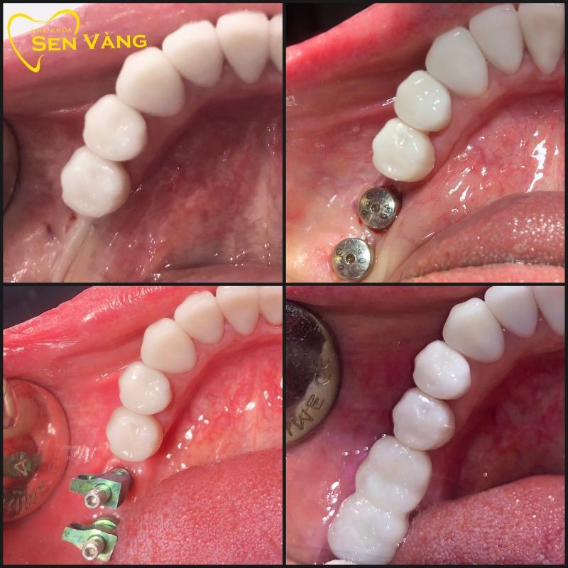 Khám phá 11 phòng khám nha khoa uy tín hàng đầu tại Quận 11, TP.HCM