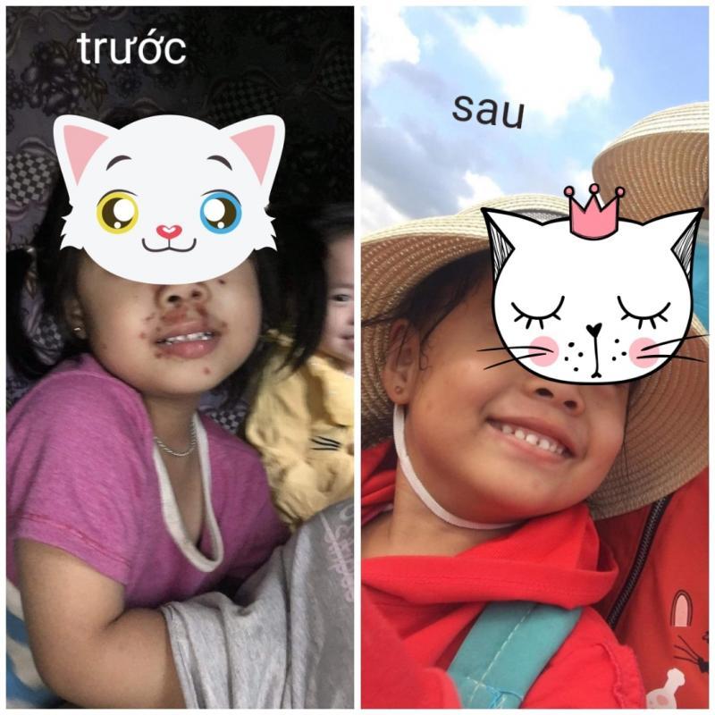 Top 2 phòng khám da liễu hàng đầu tại Quảng Bình