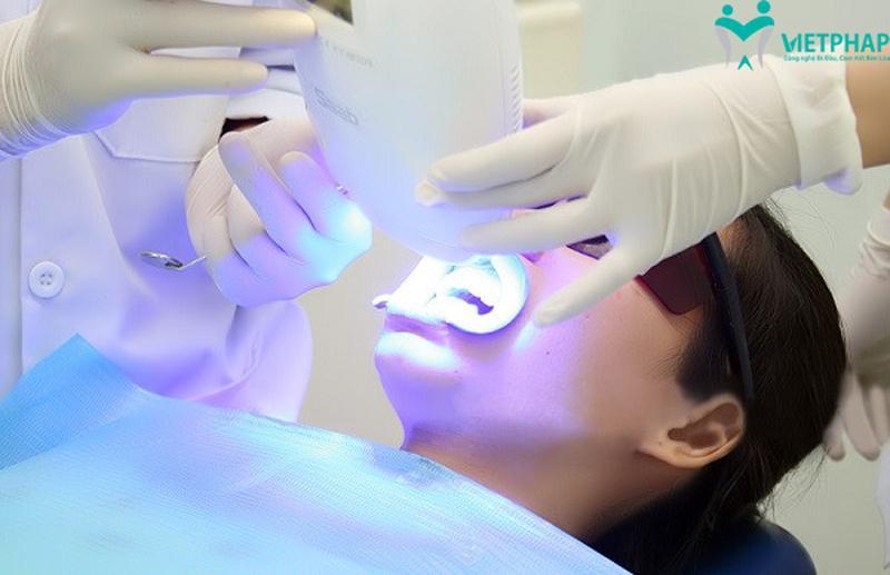 Top 5 phòng khám nha khoa tẩy trắng răng uy tín tại quận Hai Bà Trưng, Hà Nội