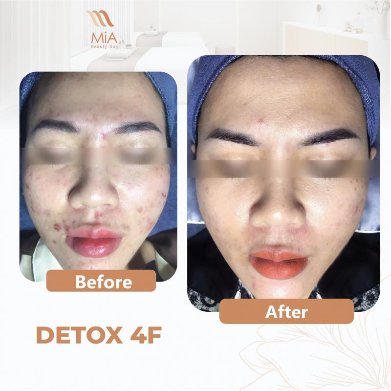 Top 8 Spa Chăm Sóc Da Mặt Tốt Nhất Tại Quận 6, TP.HCM