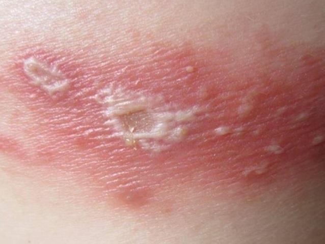 9 Điều Quan Trọng Cần Biết Về Kiến Ba Khoang